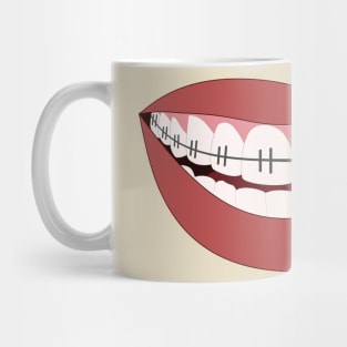 Braces Teeth Smile Orthodontist Dentist Mask Face Cover  2020 Mug